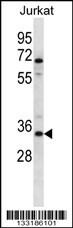 OR2G3 Antibody