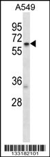TCP11L2 Antibody