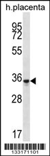 OR6K6 Antibody