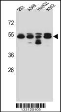 TUBB8 Antibody