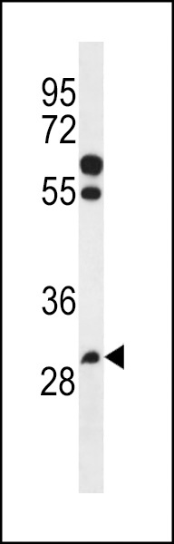 PGAP3 Antibody