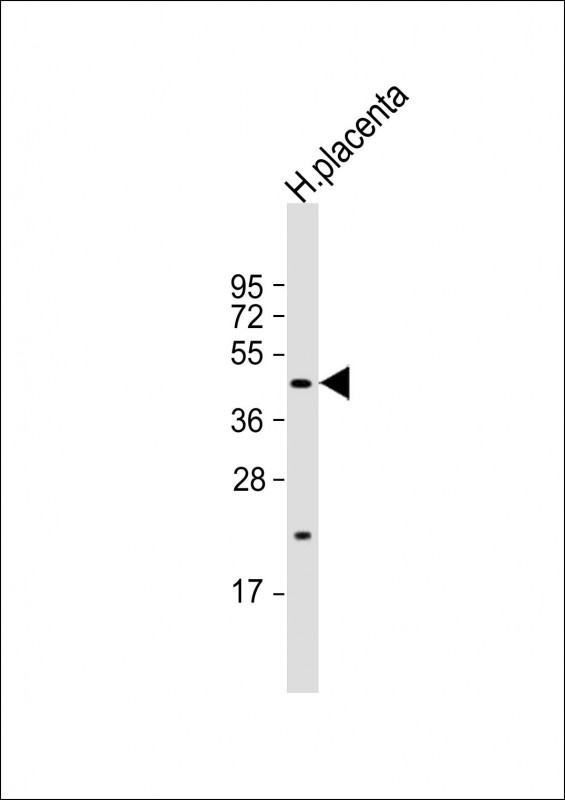 SGPP1 Antibody