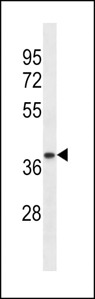 TRA2A Antibody