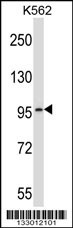 PDE6A Antibody