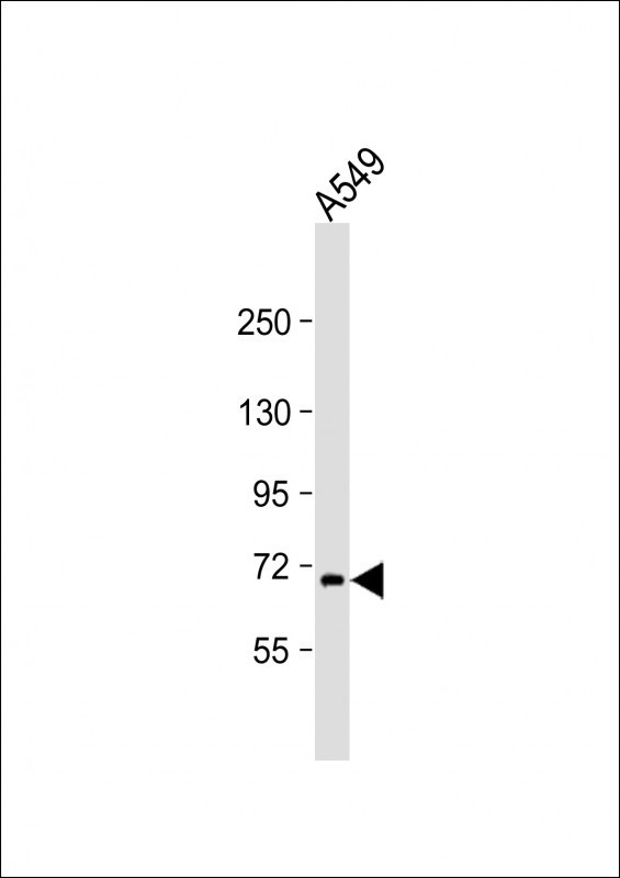 RNF43 Antibody