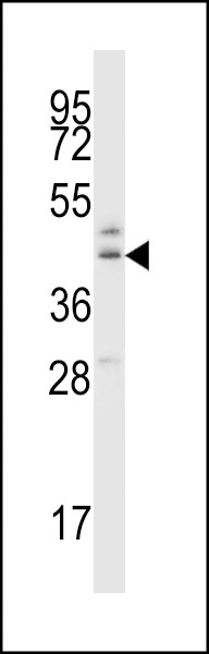 B3GNT1 Antibody
