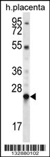 LHFPL1 Antibody