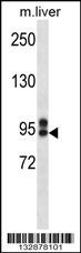 ABCC12 Antibody