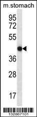 FGD2 Antibody
