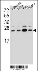 SSR2 Antibody