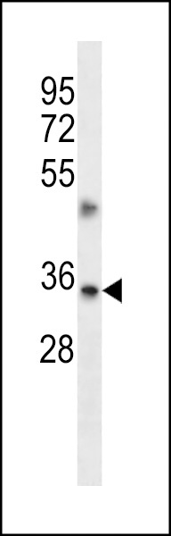 TMBIM1 Antibody