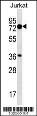 PLS1 Antibody