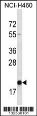 TMED2 Antibody