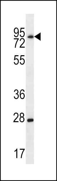 LIMD1 Antibody