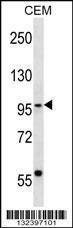 SEC63 Antibody