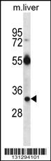 RASD1 Antibody