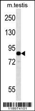 EIF2B5 Antibody