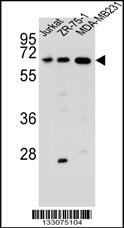 ZSCAN2 Antibody