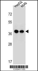 ERLIN1 Antibody