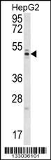 WDR12 Antibody