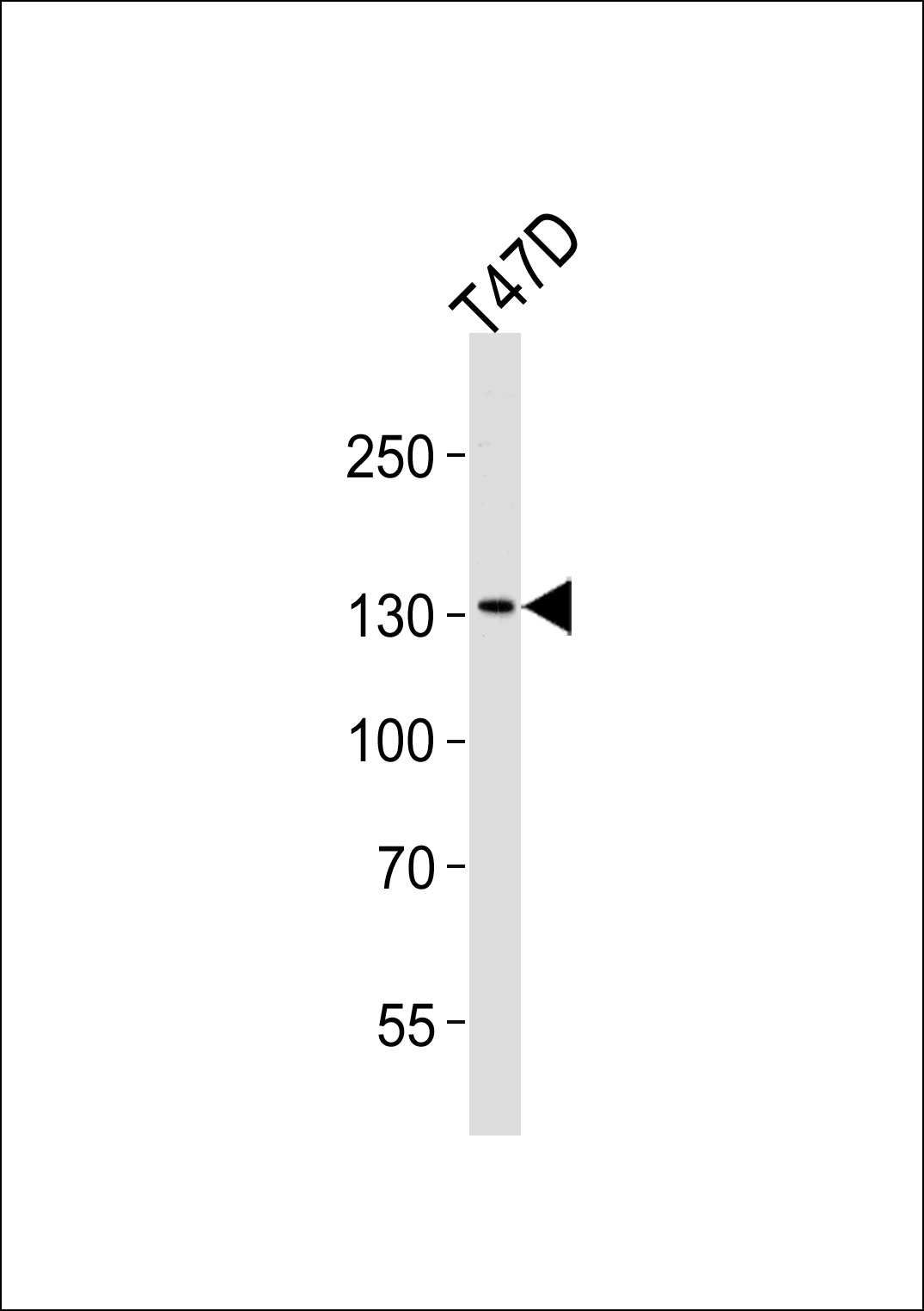 ATAD2 Antibody