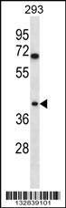 TOR1B Antibody