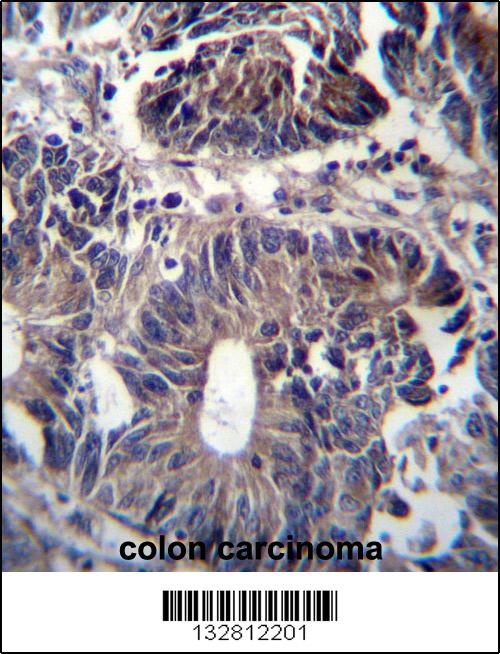 ZFYVE19 Antibody