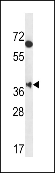 MBNL2 Antibody