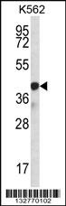 SP6 Antibody