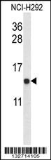 UQCRB Antibody