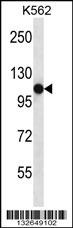 SEMA4C Antibody