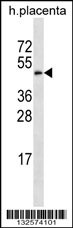 GAL3ST4 Antibody