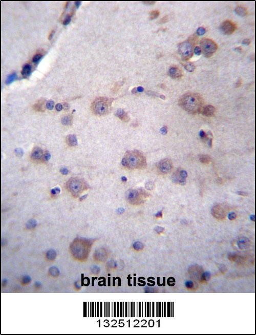 NDUFAF4 Antibody