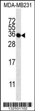 TAS2R1 Antibody