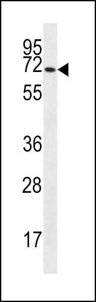 SLC6A14 Antibody