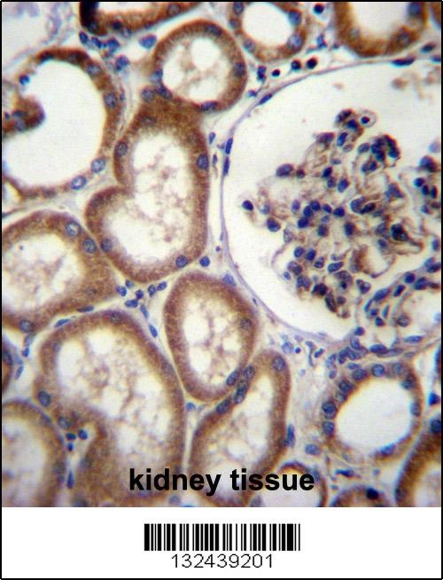 MBTPS2 Antibody