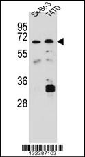 CES4A Antibody