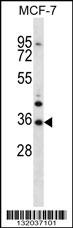 MORN3 Antibody