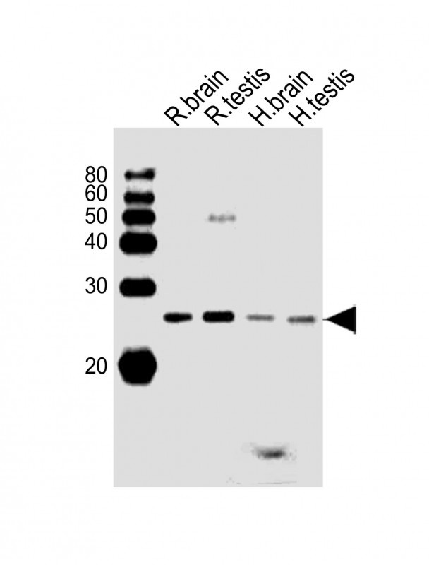 RAB11B Antibody