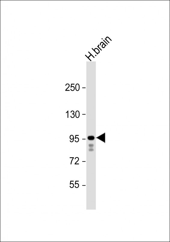 GRIA4 Antibody