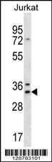 DNAJC9 Antibody