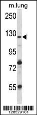 VPS54 Antibody