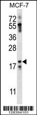 NRN1L Antibody