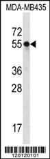 SLC15A3 Antibody