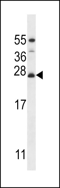 MRPL50 Antibody