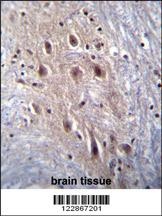 HIPK4 Antibody