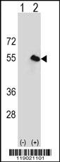 CPN1 Antibody