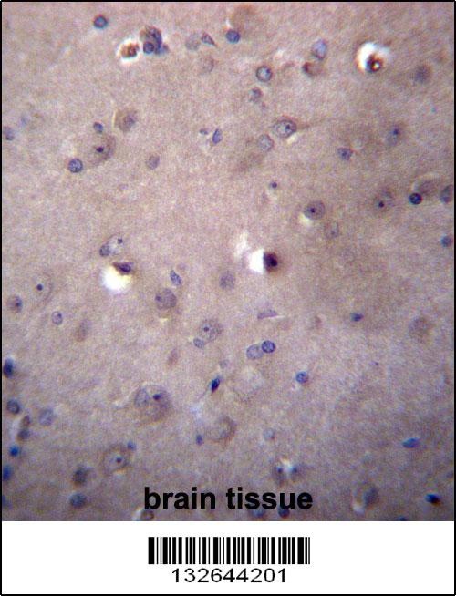 ALDH3B2 Antibody