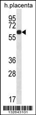 GLCCI1 Antibody