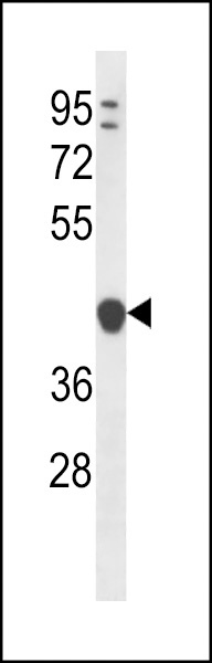 YIPF1 Antibody